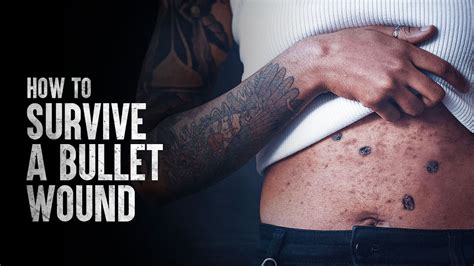 Bullet scars. Things To Know About Bullet scars. 