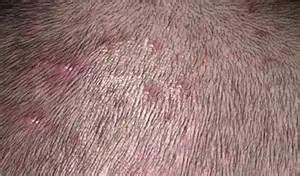 Bumps on Scalp That Itch and Hurt IYTmed.com