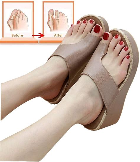 Bunion shoe. The best way to alleviate bunion pain is to wear properly fitting shoes. Always wear shoes made of soft leather or materials that form around the bunion. The bunion area should be void of seams. Shoes designed with a high, wide toe box are recommended for people suffering from forefoot disorders such as bunions. 