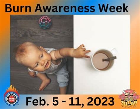 Burn Awareness Week (Feb 5th to Feb 11th) Days Of The Year