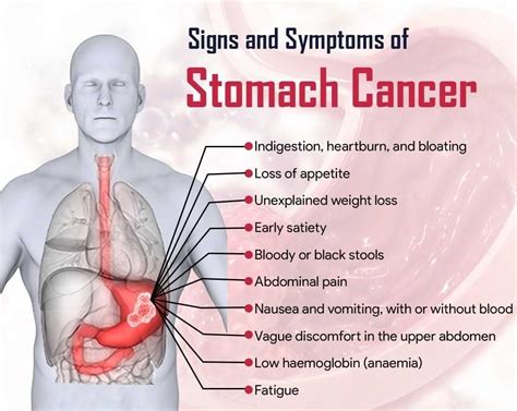 Burning breast pain and pain in abdomen. Cancer Chat