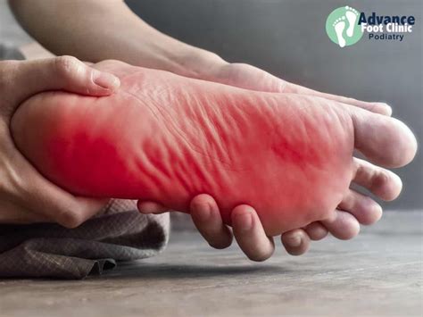 Burning sensation in foot when walking