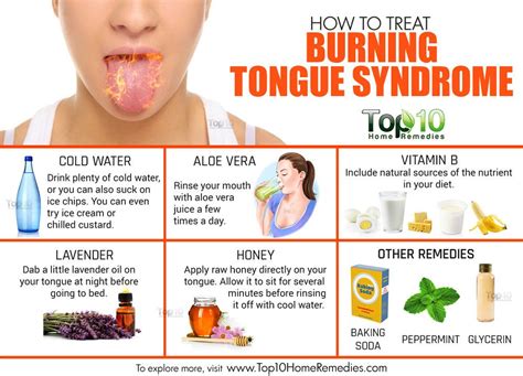 Burning tongue (burning mouth syndrome): Causes and home remedies