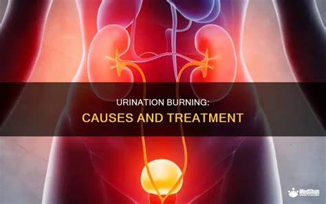 Burning while urinating after sex.  Experiencing pain during urination ...