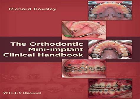 By richard cousley the orthodontic mini implant clinical handbook 1st. - Handbook of pharmaceutical excipients for cd rom book package.