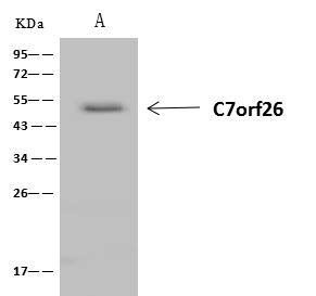 C7orf26 protein expression summary - The Human …