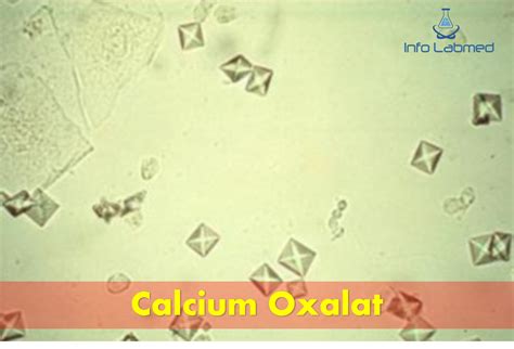 Ca Oxalat Positif Artinya - wintechmobiles.com