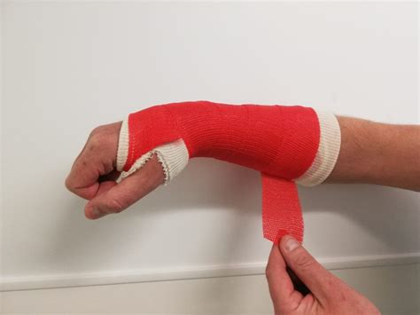 Caring for your plaster cast | Fracture Clinic - muktibox.com
