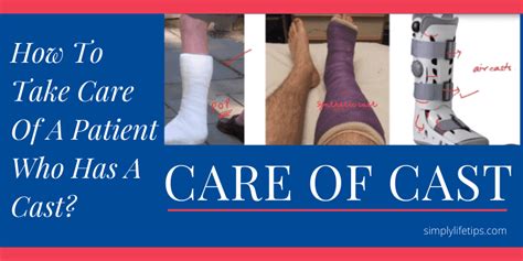 Cast Care Tips - DHMC and Clinics - muktibox.com