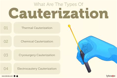 CAUTERIZATION English meaning - Cambridge Dictionary