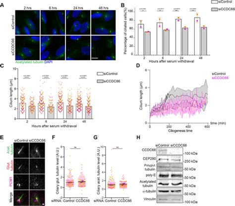 CCDC66 regulates primary cilium length and signaling via …