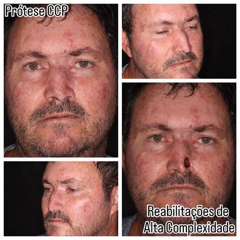 ccp pro - elchoricharrua.com