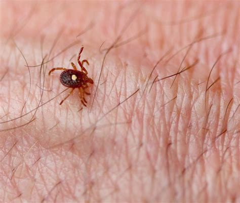 CDC: Meat allergy caused by tick bites is a growing concern