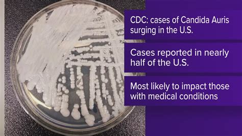 CDC warns of drug-resistant, deadly fungus: How is it spread?