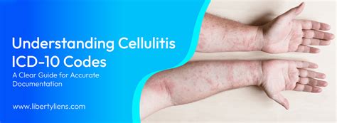 cellulitis icd - elchoricharrua.com
