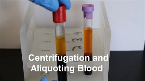 Centrifugation and Aliquoting of Blood Serum and Plasma - wintechmobiles.com