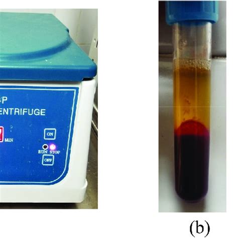 Centrifuge Blood Separation: Process and Practical Uses - wintechmobiles.com