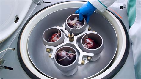 Centrifuges: Components of All Blood Bank Operations - wintechmobiles.com