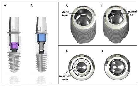 Changes in the Abutment-Implant Interface in Morse Taper Implant ... - wintechmobiles.com