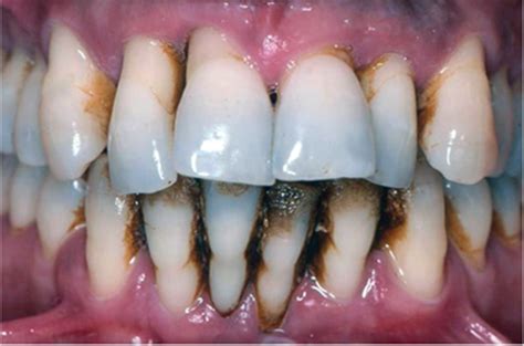 Chap 17 Flashcards | Quizlet - wintechmobiles.com