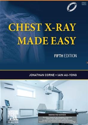 chest x ray made easy pdf - elchoricharrua.com