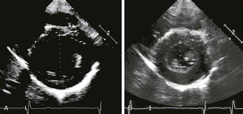 CHRISTUS Health Reg Non-Invasive Imaging Pediatric Echo …