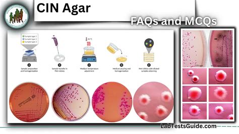 CIN Agar 50 FAQs and 30 MCQs Lab Tests Guide. 