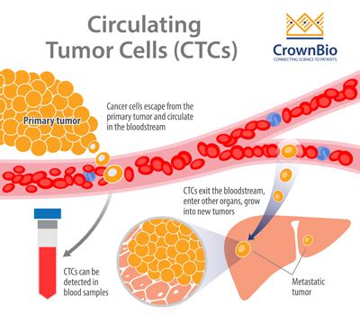 Circulating Tumor Cells: Isolation, Preclinical Models, and Clinical ... - muktibox.com