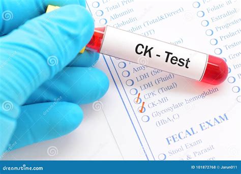 CKS Tests