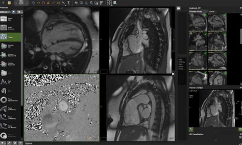 CMR Logbook Course studying 20 Essential Congenital Cases