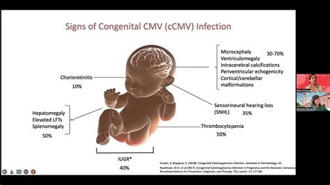 CMV: Designer babies aren