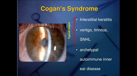 cogan sd - elchoricharrua.com