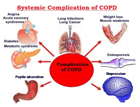 COPD and Kidneys - COPD Foundation