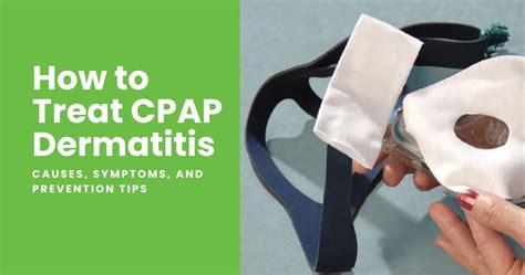 CPAP Dermatitis Causes and Prevention