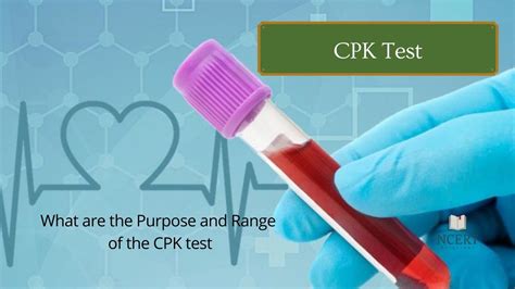 CPK Test Process, Purpose and Normal Range infrexa