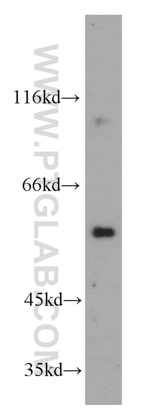 CPNE9 Antibody (20098-1-AP)