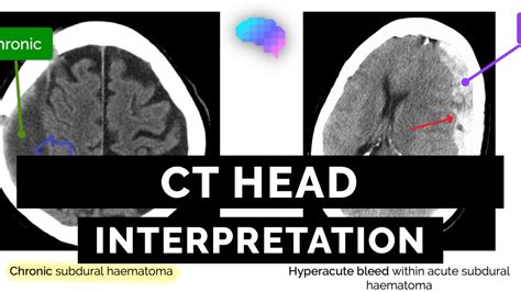 CPSA Brain Exam