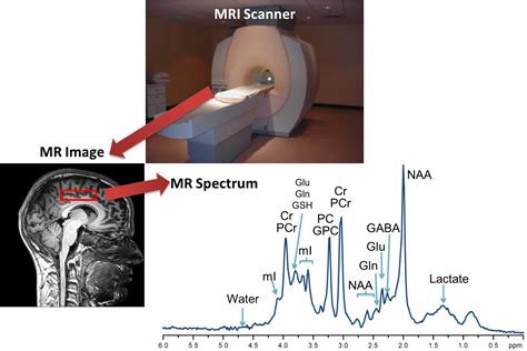 CPT® Code 0612T - Magnetic Resonance Spectroscopy Imaging …