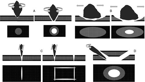 Cranial trepanation in primitive cultures - ScienceDirect - wintechmobiles.com