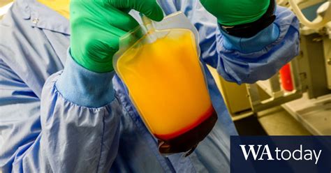 CSL powers forward with plasma treatment research