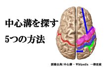 CTで中心溝を簡単に同定する5つの方法！ 広島リハビリ勉強 …