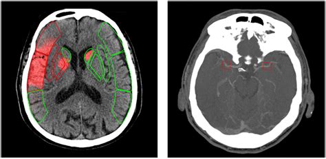 CT-AI Examengine