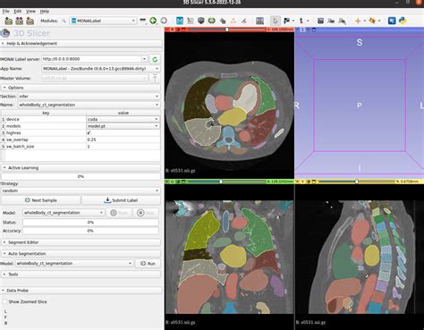 CT-AI Unterlage.pdf