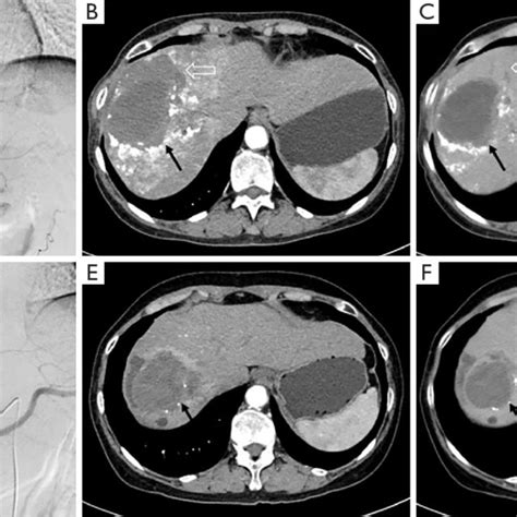 CT-TAE Examengine