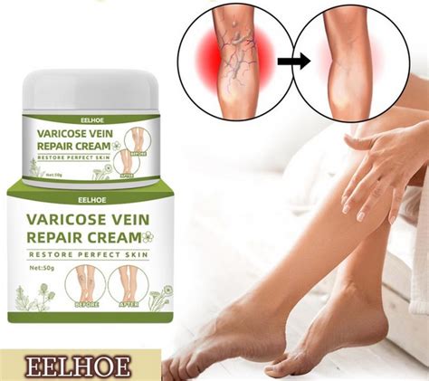 Caj za prosirene vene. .  ...