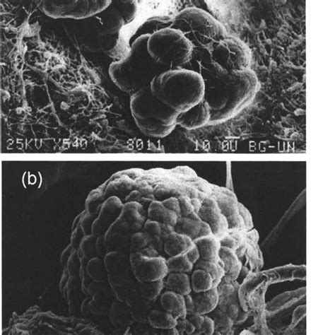 Calcite microcrystals in the pineal gland of the human brain: first ...