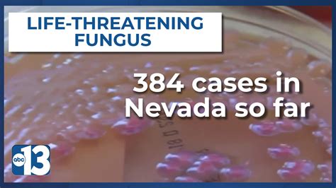 California, Nevada states with most superbug fungus infections
