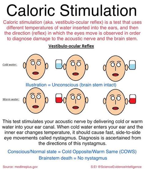 Caloric stimulation is a test for checking of brain damage using
