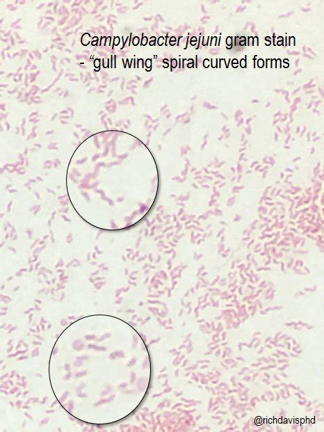 Campylobacter jejuni on Microscopy - "gull wing" spiral ...