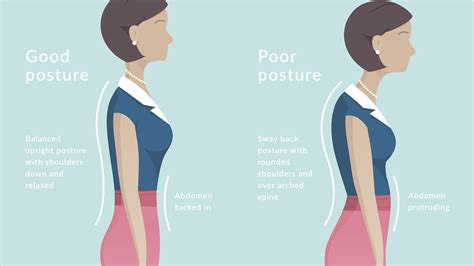 Can Pilates Correct Poor Posture?